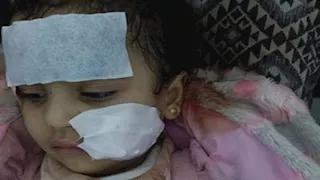 "9 غرز في الوجه".. التفاصيل الكاملة لـ هجوم شبل أسد على طفلة داخل سيرك العجوزة