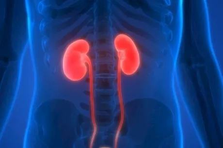 هل التهاب الكلى يحتاج إلى غسيل؟- حسام موافي يجيب ويحسم الجدل
