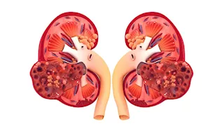  علامات مبكرة تنذرك بالفشل الكلوي.. لا تتجاهلها