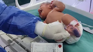 فحص 735 ألف مولود.. ماذا قدمت مبادرة الكشف عن الأمراض الوراثية؟