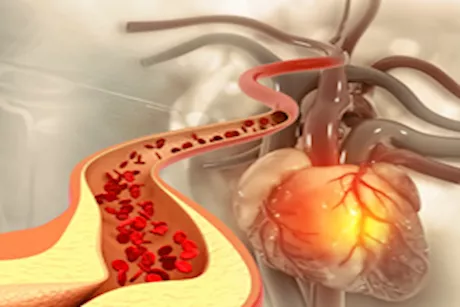عادات صباحية فعالة تخفض الكوليسترول المرتفع.. حافظ عليها