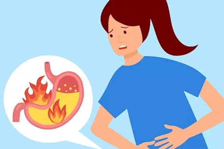 حرقة المعدة بسبب الدواء- 10 أدوية تجعلك تعاني من الحموضة