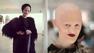 صلعاء وبدون أسنان.. من هي عارضة الأزياء ميلاني جايدوس؟