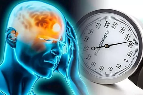 شكل صداع ارتفاع الضغط- تعرف على علاجه وكيفية الوقاية منه