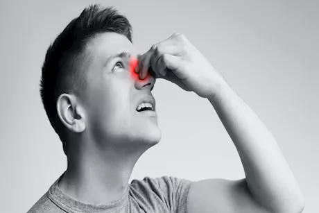 من الحساسية إلى الربو.. حالات يمكن أن تتسبب في ظهور زوائد الأنف