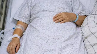 إنقاذ مريضة من سكتة دماغية حادة بعد تدخل سريع في الدقهلية