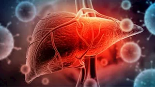 الإنذار الأخطر.. علامة غير متوقعة تكشف مرض الكبد مبكرا