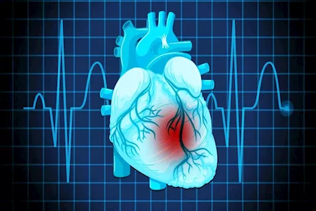 مرض الشريان التاجي.. الأعراض المبكرة وطرق الوقاية والعلاج