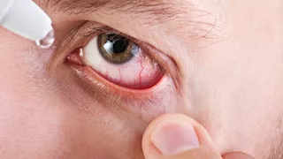 الصحة العالمية: مصر خالية من التراكوما وتصل إلى "المستوى الصفر".. القرار جاء بعد سنوات من البحث