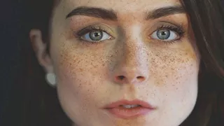    هل ظهور النمش بكثرة في الوجه إنذار مبكر لمرض خطير؟