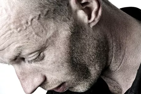 انتفاخ عروق الرأس- طبيب يحذر: يستدعي زيارة الطبيب في هذه الحالة