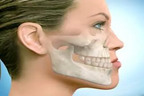 ما هي العضة المعكوسة؟.. وكيف يتم علاجها؟