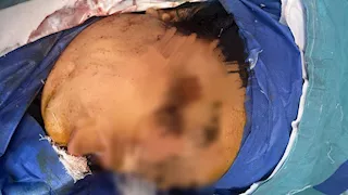 "28 طعنة وسكينة في الجمجمة".. والد "شهد" يروي تفاصيل تعرضها للطعن على يد خطيبها من المعصرة