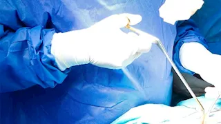 عملية معقدة بالفيوم تنتهي باستئصال ورم دون التأثير على نظر مريضة