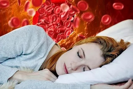 علامات ارتفاع الكوليسترول- 7 أعراض تحدث أثناء النوم احذرها