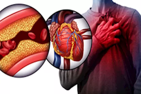 طبيب يحذر.. الكوليسترول المرتفع يهدد القلب دون سابق إندار
