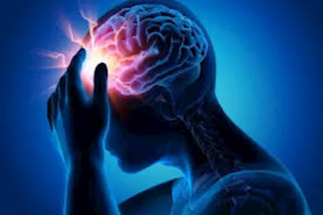 كيف يمكن لمرضى كهرباء المخ الزائدة تقليل النوبات؟.. طبيب يجيب