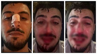 العريس واثنان آخران.. التحقيق مع المتهمين بالتعدي على صاحب فيديو زفة دهشور