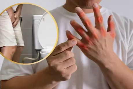 أعراض ارتفاع حمض اليوريك- 6 علامات تظهر في البول احذرها