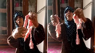 بعد واقعة "سيدة كيس اللحمة".. طبيبة تكشف الجانب المظلم لـ "هوس التريند"