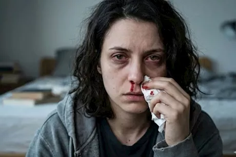 تأثير قلة النوم على الجسم- طبيب يجيب: هل تسبب نزيف الأنف؟