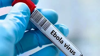 فرنسا تعلن تسجيل أول إصابة مؤكدة بفيروس إيبولا