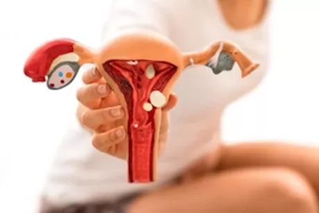 علامات مفاجئة لمرض بطانة الرحم المهاجر في الساق