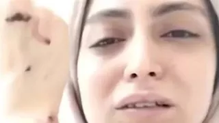 "كسر مضاعف واتهام صادم".. تطورات جديدة في واقعة طبيبة أسنان شبرا الخيمة