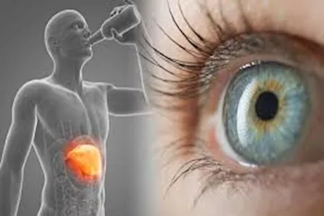 التهاب الكبد.. هل يمكن أن يؤثر على شبكية العين؟.. استشاري يجيب
