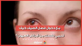 مع دخول فصل الصيف كيف تحمي نفسك من أمراض العيون ؟