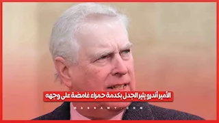 الأمير أندرو يثير الجدل بكدمة حمراء غامضة على وجهه
