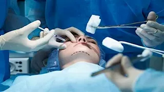بعد معاناة غادة عادل.. ما مخاطر حقن الفيلر الدائم على الوجه؟