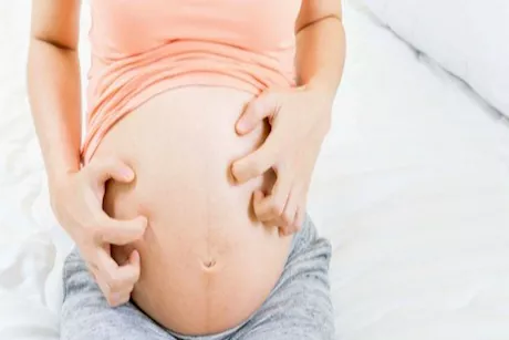 أسباب الحكة والهرش في الثلث الأخير من الحمل.. طبيب يوضح