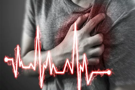 من الأكثر عرضة للإصابة بتمدد الشريان الأورطي؟ استشاري يوضح