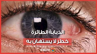 الذبابة الطائرة خطر لا يستهان به.. الدكتور إيهاب سعد أستاذ العيون بجامعة القاهرة يكشف تفاصيل مرض يصيب العيون