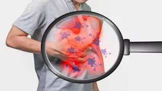  أطعمة وعادات يومية تساعد على تقليل الالتهاب المزمن