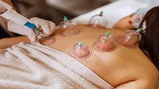 5 فوائد محتملة للحجامة.. هل تستحق التجربة؟