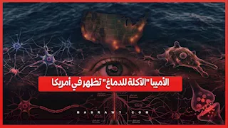 بعد وفاة طفلة.. إصابة جديدة بالأميبا "الآكلة للدماغ" في أمريكا