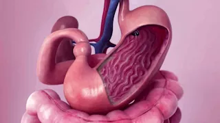 من الزبادي إلى العدس.. 5 أطعمة تعزز صحة المعدة والأمعاء