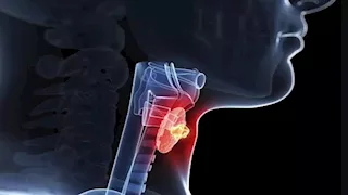 كيف تكتشف إصابتك بالتهاب الغدة الدرقية؟.. احذر 10 أعراض