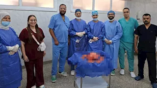 حالة نادرة لا تتكرر.. طبيب يروي كواليس استئصال ورم 10 كيلو بأسيوط  