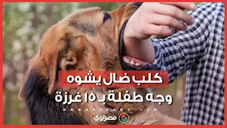 كلب يهاجم طفلة وتنقل للمستشفى بحالة حرجة