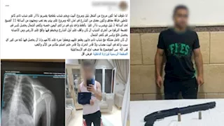 "طلقة طائشة وسط الشارع".. كواليس إصابة عابر سبيل في مشاجرة بالأسلحة بـ الإسماعيلية