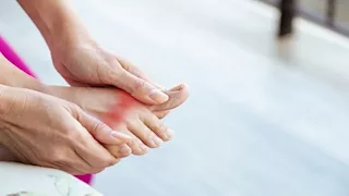 النقرس.. ما أسبابه ومن الفئات الأكثر عرضة للإصابة به؟